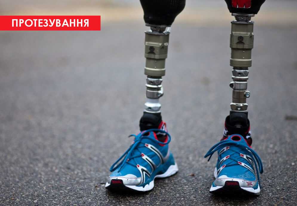 Люди з інвалідністю: особливі потреби чи обмежені можливості?